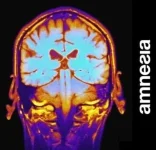 Amnesia - Brain.webp
